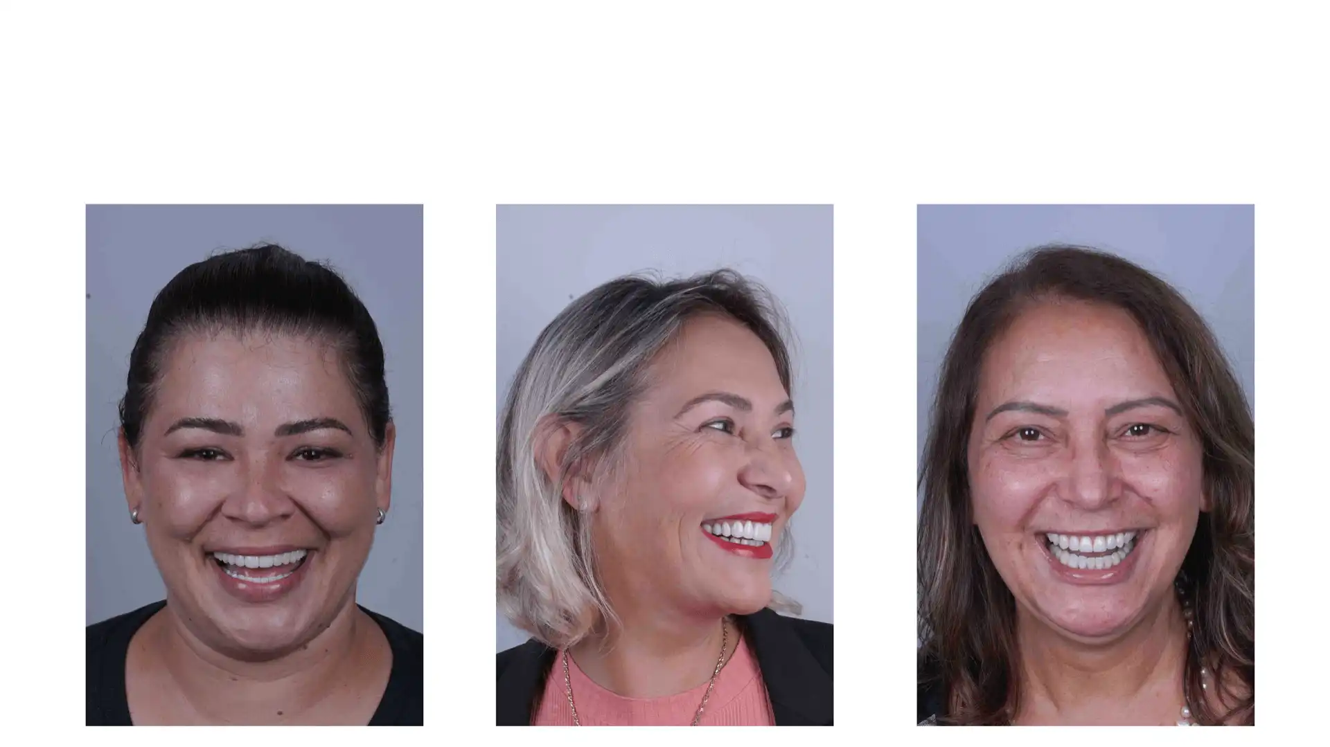 Paciente com dentes perfeitos 2